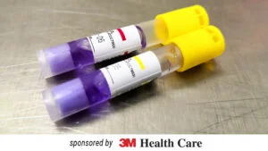 Positive Biological Indicators